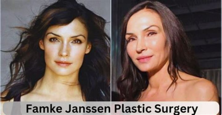 A Deeper Look: Famke Janssen's Plastic Surgery Journey