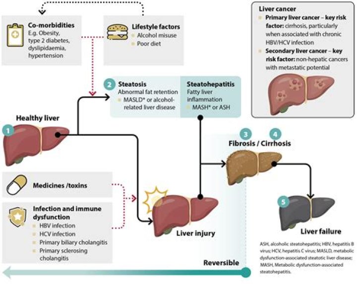 Understanding Mouth Sores And Elevated Liver Enzymes: Causes And Treatment